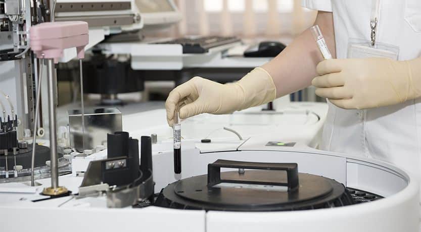 Laboratory technician handling blood test samples using advanced diagnostic equipment at MD Urgent Care.