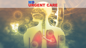 Read more about the article The Complete Guide to Upper Respiratory Infection