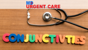 Read more about the article Conjunctivitis or Pinkeye